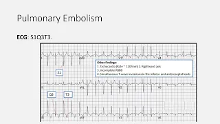 Respiratory Emergencies Summary for MRCEM intermediate SBA