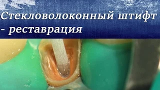 Как восстановить передний зуб. Реставрация резца. Терапевтическая стоматология