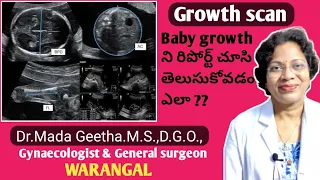 8 month pregnancy scan report/ Foetal growth scan in Telugu/ 32 weeks pregnancy scan/Dr.Mada Geetha