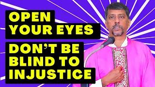 Sermon - Open Your Eyes Don’t Be Blind To Injustice - Fr. Bolmax Pereira