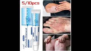 Psoriasis Cream For Dermatitis Ointment Anti-Itch Antibacterial Eczematoid Skin Care Cream
