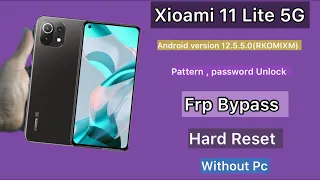 Xiaomi Mi 11 lite 5G Ne Frp Bypass | Hard Reset | Mi Google Account Remove | Without Pc