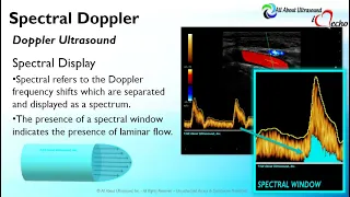 Doppler Principles: Spectral Doppler