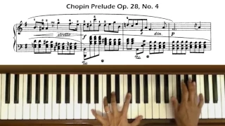 Chopin Prelude Op. 28, No. 4 in E Minor