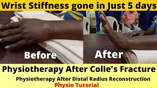 Physiotherapy After Wrist surgery.Physiotherapy After Colle's Fracture.Physio For Wrist Stiffness