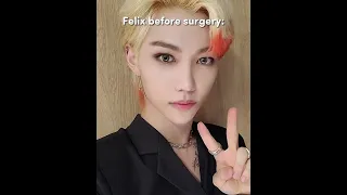 Felix before surgery 🤍 #straykids #shorts