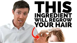 The BEST Hair Supplements Contain This Ingredient