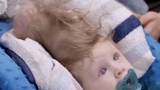 Miracle surgery saves baby born with brain growing outside his head