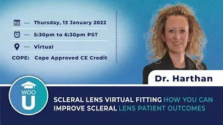 Scleral Lens Virtual Fitting