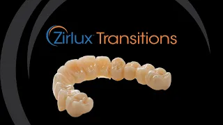 Zirlux Transitions: Sintering Oven Calibration Ring Procedure