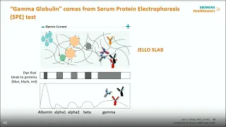 Evaluating Monoclonal Gammopathy of Undetermiend Significance (MGUS) with Free Light Chain Assays...