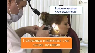 Грибковая инфекция уха: схема лечения, которая приводит к выздоровлению