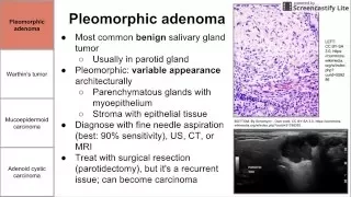 Salivary Gland Neoplasms