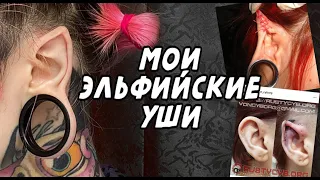 Модификация эльфийские уши  Моя история