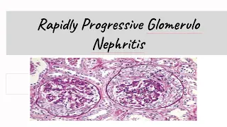 Rapidly Progressive Glomerulonephritis ( RPGN)