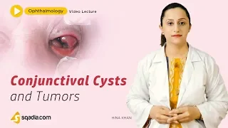 Conjunctival Cysts and Tumors | Ophthalmology Lecture | MBBS Student Study | V-Learning