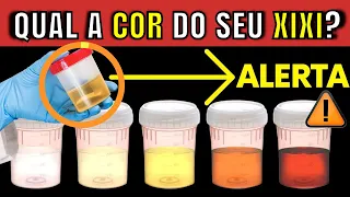 WHAT YOUR URINE COLOR SAYS ABOUT YOUR BODY'S HEALTH | WARNING SIGNS THAT SOMETHING IS NOT GOING WELL