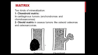 2- Bone TUMORS (2)