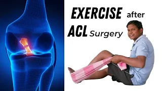 ACL Rehab Exercises after ACL Reconstruction Surgery