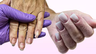 Преображение ногтей / Сложный маникюр / Исправление ногтей / Наращивание