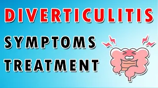 Diverticulitis Symptoms and Treatment