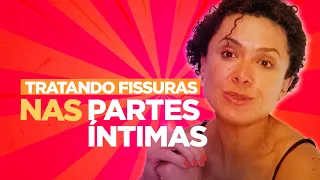 Como tratar FISSURAS NAS PARTES ÍNTIMAS? | Dra Patricia Bretz