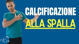 Cosa fare se hai una CALCIFICAZIONE alla SPALLA (guida completa)