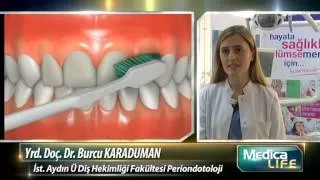 Diş Eti Hastalıklarının Sebebi ve Tedavi Yöntemleri Nelerdir?