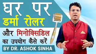 TUTORIAL- घर पर DERMA ROLLER  और MINOXIDIL  का USE  कैसे करें ? - Dr. Ashok Sinha