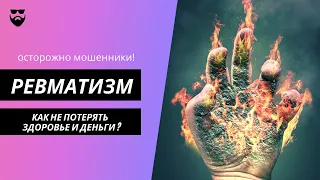 Ревматизм - как не потерять здоровье