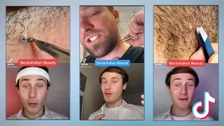 The Best TikTok Ingrown Hair Removal Reactions Compilation!