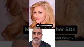 WHAT HAPPENED TO MADONNA'S FACE??? Plastic Surgeon Warns About Using FILLERS!!!