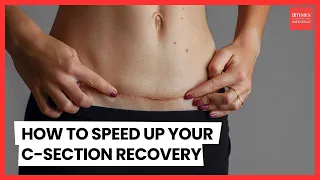 C-Section Recovery NIGHTMARE? Top Doc Reveals SHOCKING Secrets to Heal FASTER!