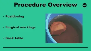 Osteochondral Allograft Transplantation - Indications, Techniques, and Outcomes