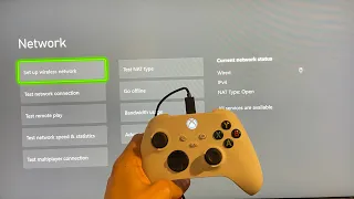 Xbox Series X/S: How to Fix Cannot Obtain IP Address Tutorial! (Network Settings) 2023