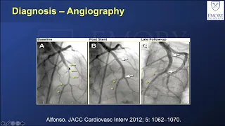 Emory Cardiology Grand Rounds 09-28-2020