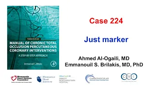 Case 224: Manual of CTO PCI - Just marker