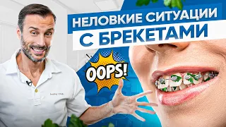 Неловкие и смешные ситуации с брекетами за всю мою практику ортодонта