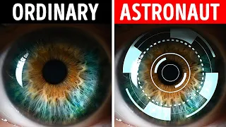 Human Eye Changes After 1 Year in Space, Here's How