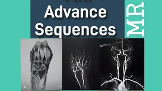 Advanced MRI sequences Technology.