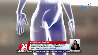 Dalagang may bukol sa maselang bahagi ng kanyang katawan, napa-operahan na ng GMA Kapuso.. | 24 Oras