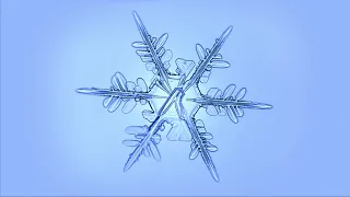 Timelapse Shows Frost Through a Microscope