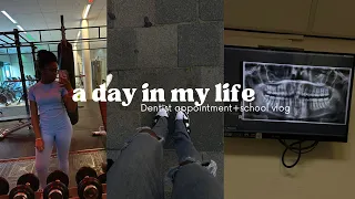 #VLOG53 day in my life + dentist appointment + school,gym vlog || Summer Fariël