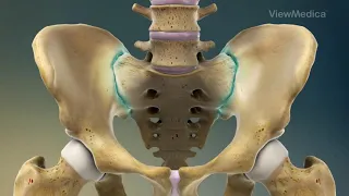 Sacroiliac Joint Steroid Injection - Pain & Wellness Centers of Southern California