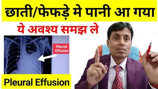 #Pleural_Effusion in Hindi // chhati me pani bhar jana // Pleural effusion Treatment by Dr Sanjay kr