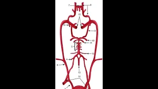 Arterial Supply of Brain Clinicals