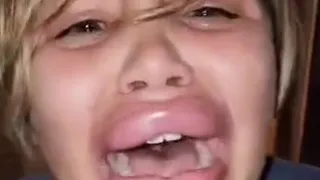 Kids copying Ishowspeed big lips challenge gone wrong #kids #ishowspeed #biglip #challenge #tiktok