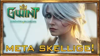 ZA(BRANA)! META SKELLIGE GWINT