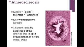 120-Overview of Diseases of Lipid Metabolism