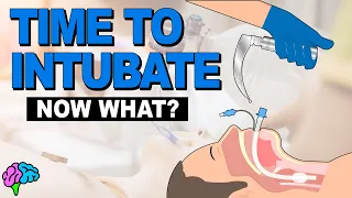 It's Time to Intubate. Now What Do We Do?